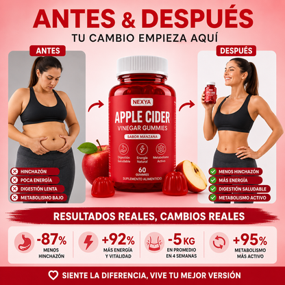 Gummies Detox de Vinagre de Manzana - Reduce barriga y vuelve a sentirte ligera este verano